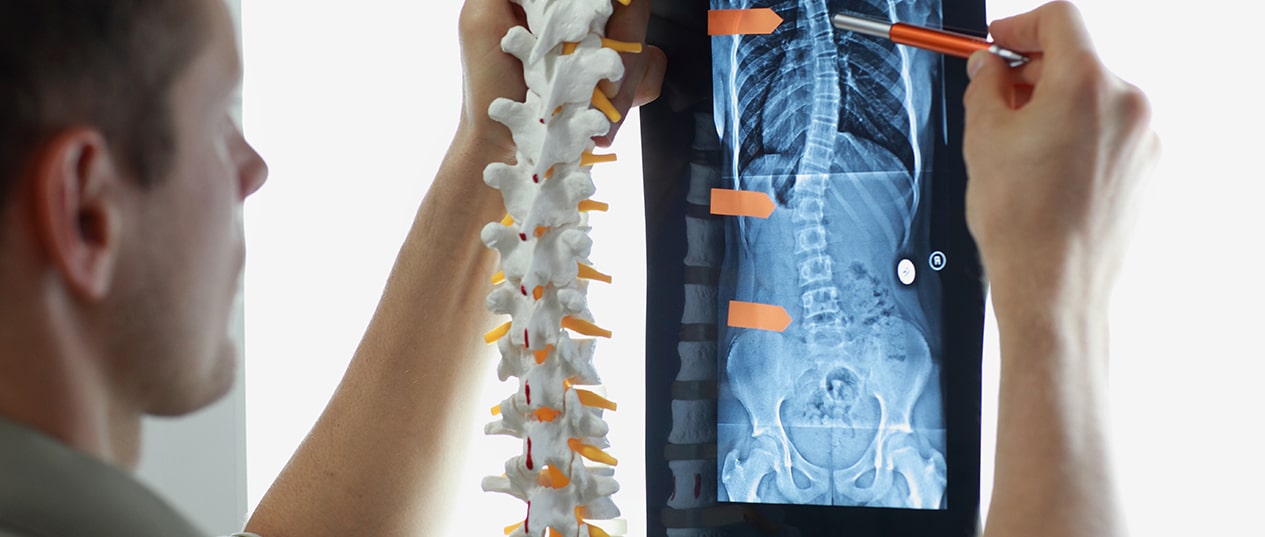 Spinal Cord Injury Lawyer Kansas City