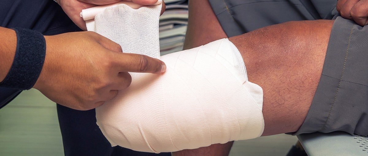 Limb loss Limb loss