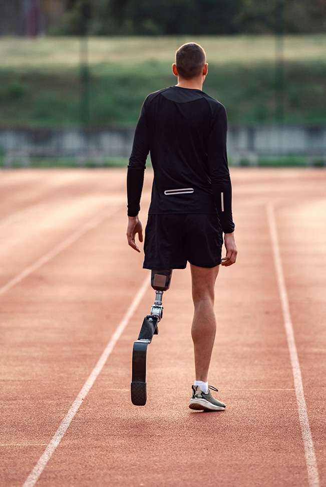 limb loss b limb loss b